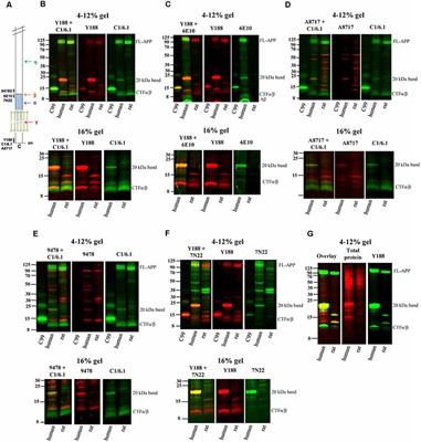 Non-specific Detection of a Major Western Blotting Band in Human Brain Homogenates by a Multitude of Amyloid Precursor Protein Antibodies